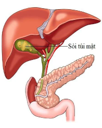 Soi Mat 1